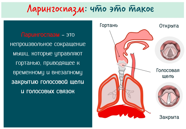 Ларингоспазм