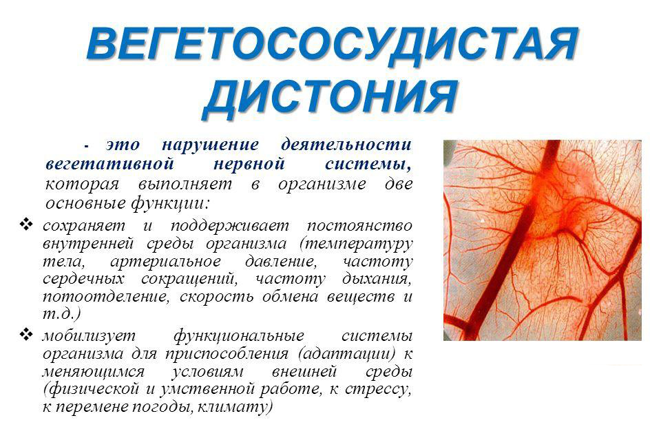 Понятие ВСД