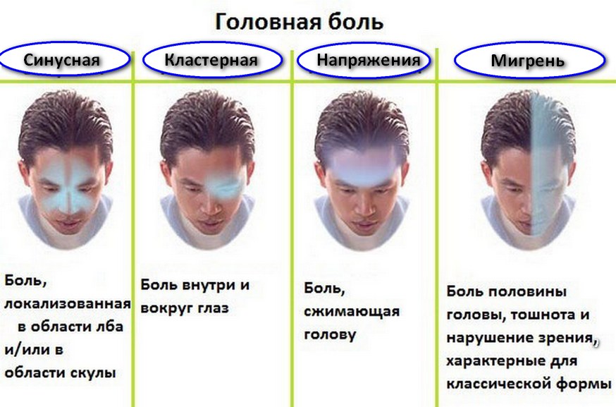 Мигрень