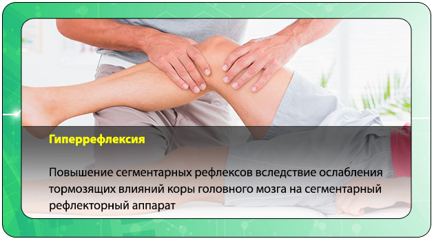 Гиперрефлексия