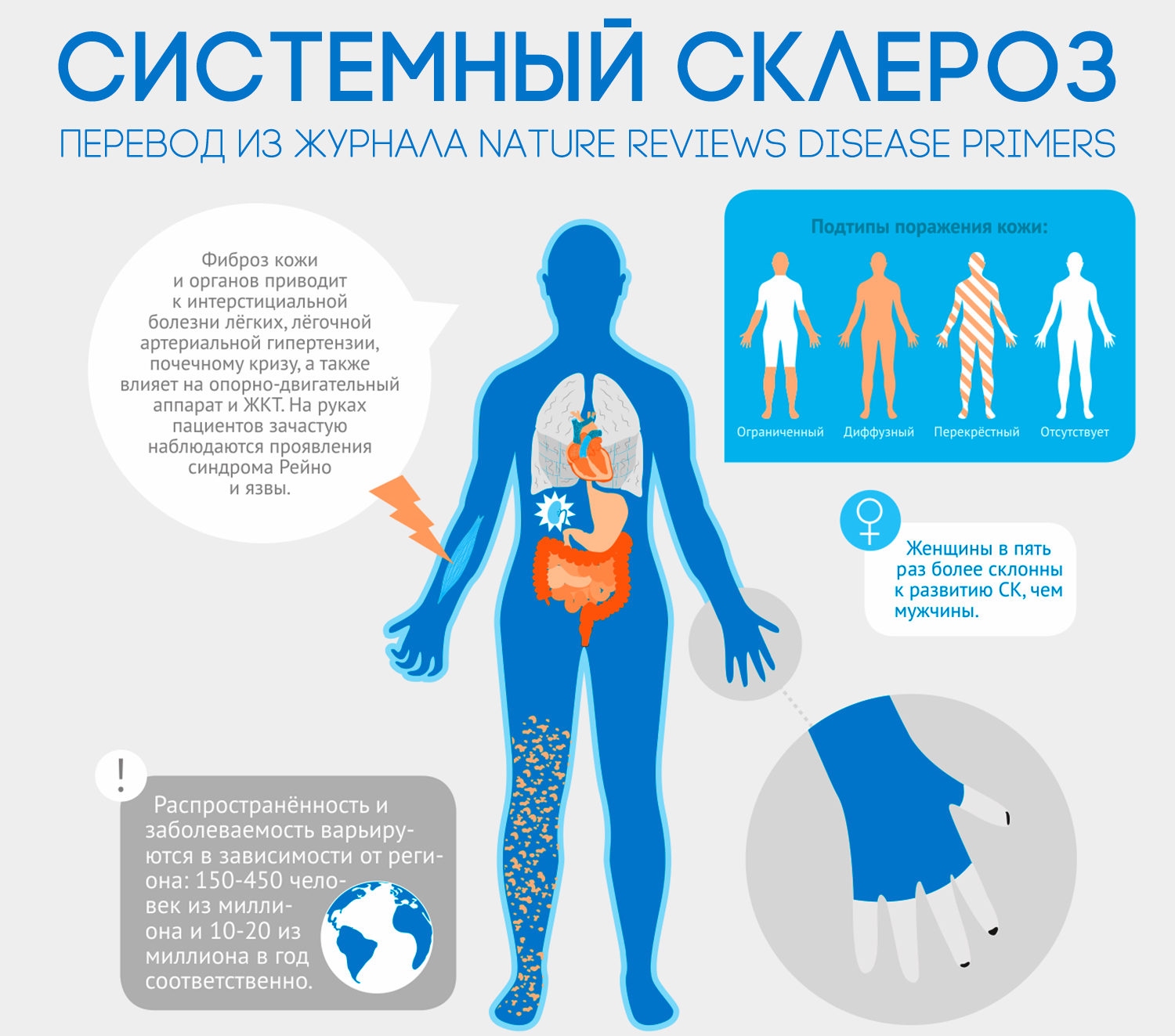 Системный склероз