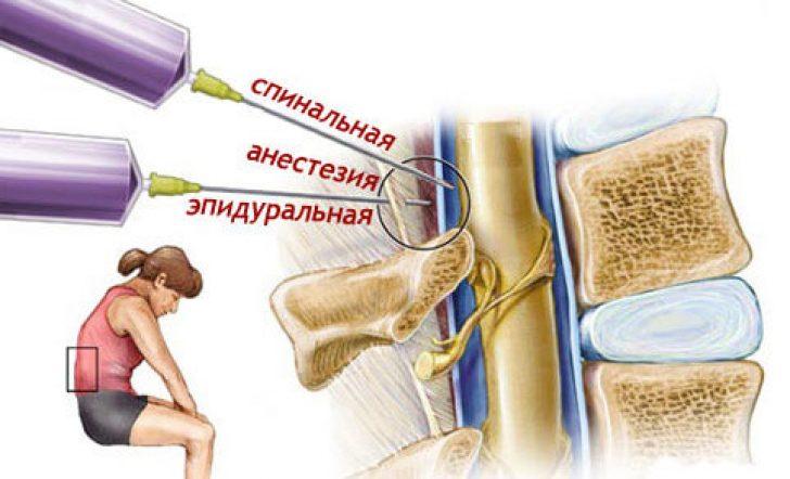 Анестезия 