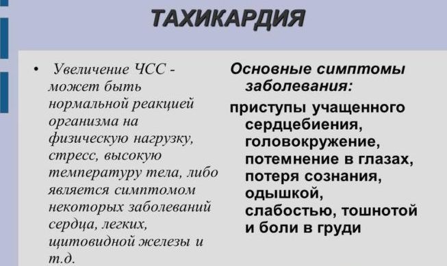 Тахикардия