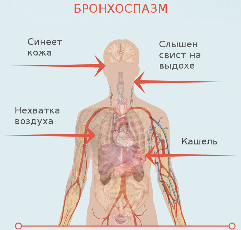 Бронхоспазм