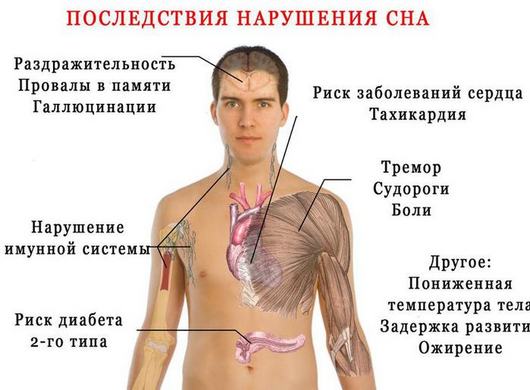 Последствия нарушения сна