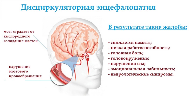 Энцефалопатия