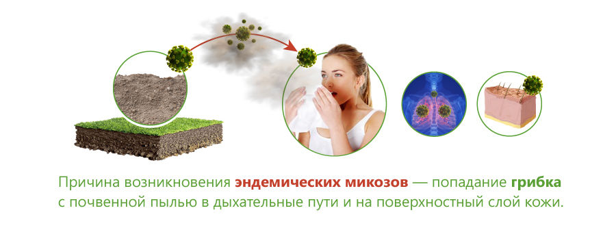 Причины развития эндемического микоза