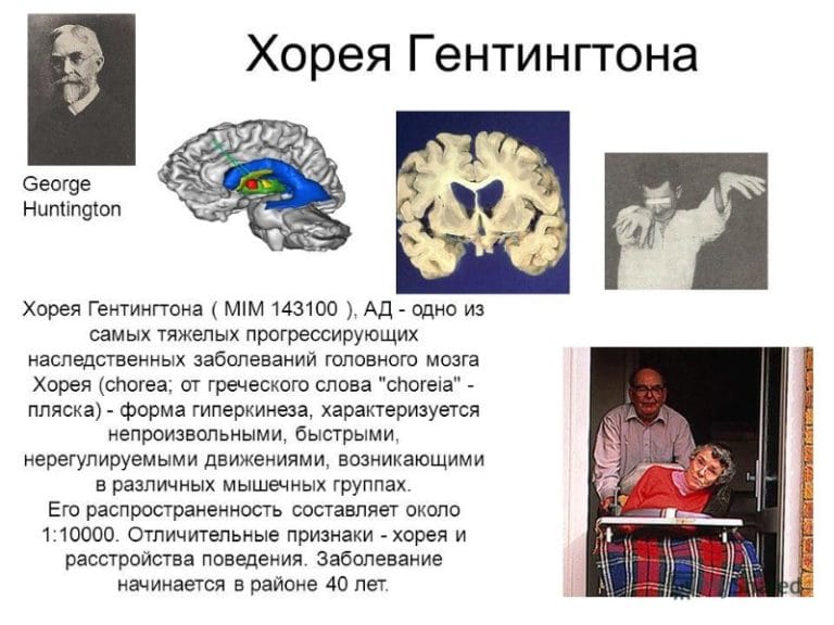 Хорея Гентингтона