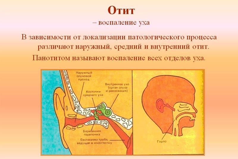 Воспаление уха