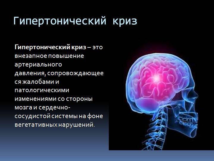 Гипертонический криз 