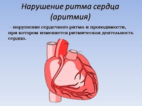 Нарушение сердечного ритма