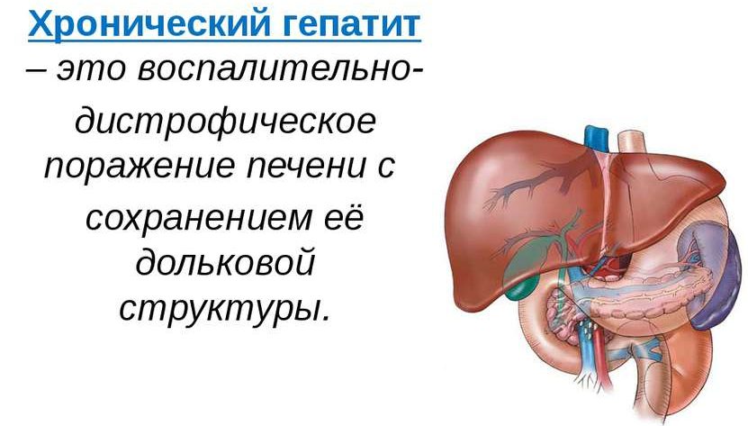 Хронический гепатит