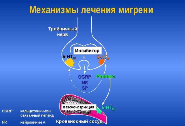 Механизм лечения мигрени