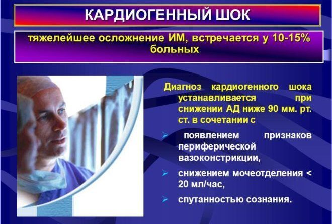 Кардиогенный шок