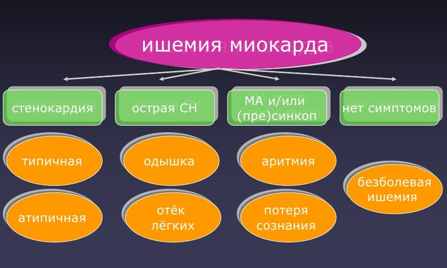 Классификация ишемии миокарда