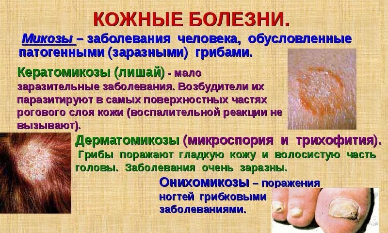 Кожные болезни
