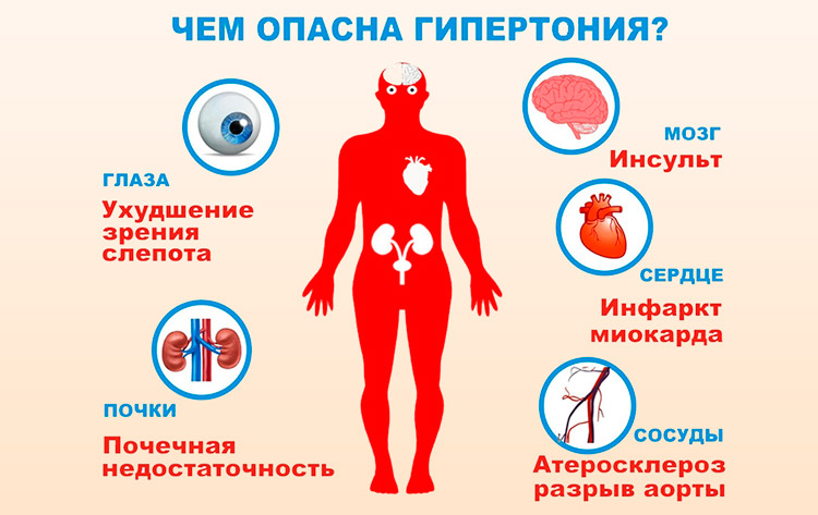 Последствия гипертонии