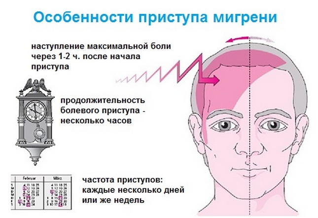 Мигрень