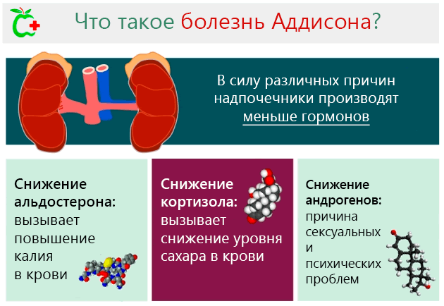 Болезнь Аддисона