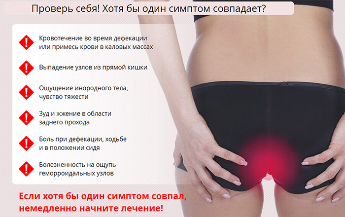 Симптомы геморроя