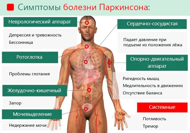 Симптомы болезни Паркинсона