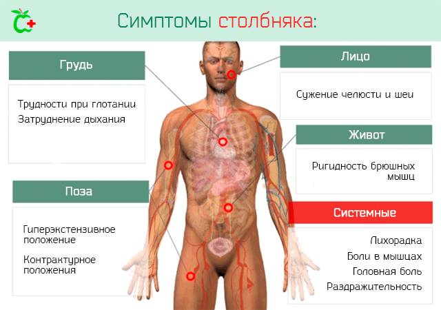 Симптомы столбняка
