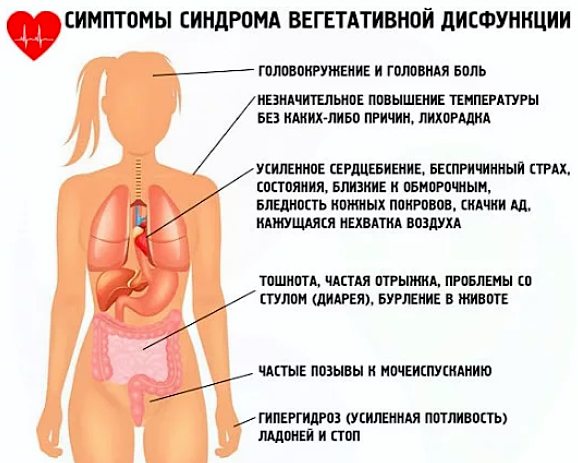 Симптомы ВСД