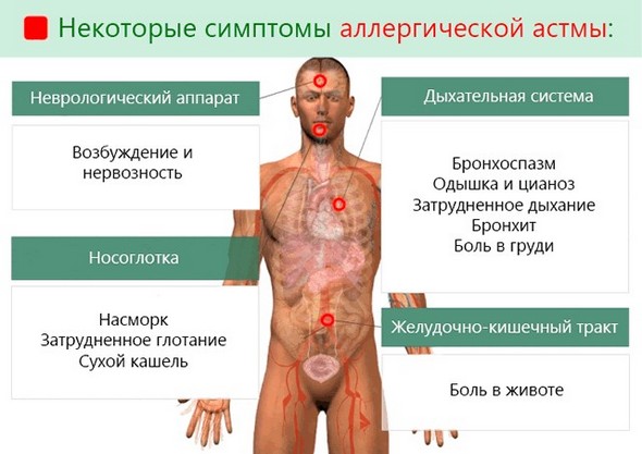 Астма