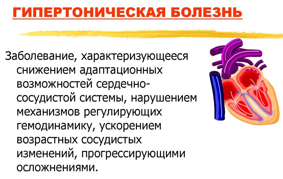 Гипертоническая болезнь