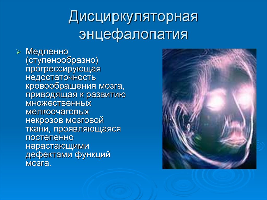 Дисциркуляторная энцефалопатия 