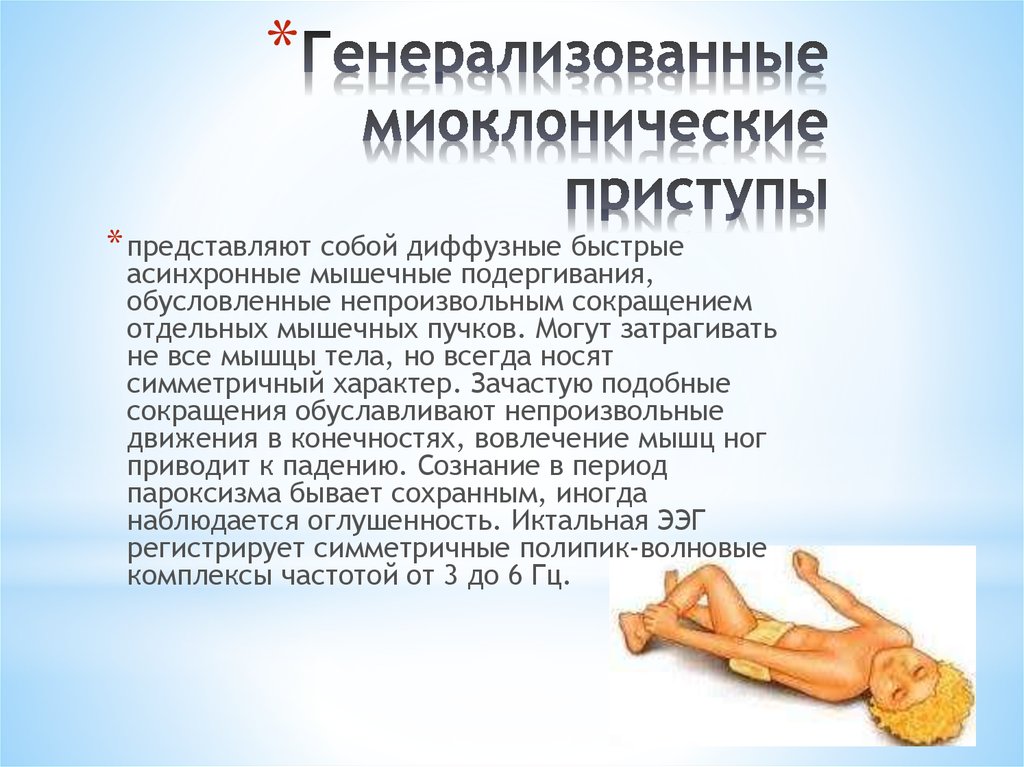 Миоклонические судороги 