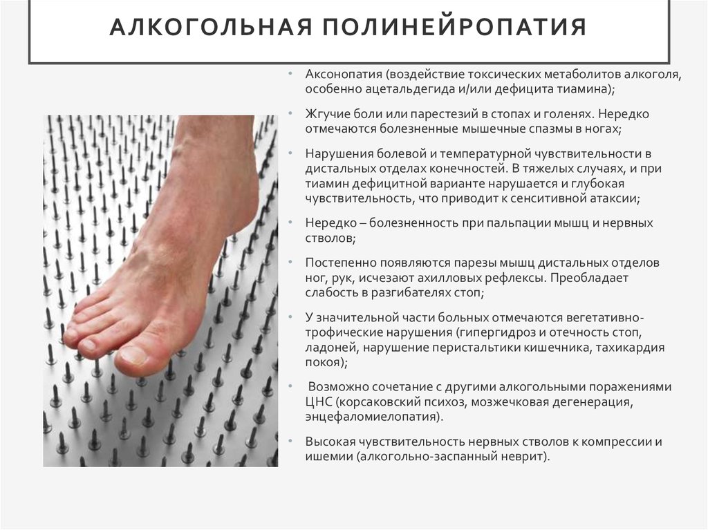 Алкогольная полинейропатия