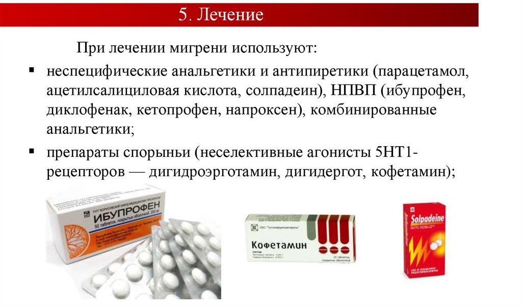 Лечение мигрени