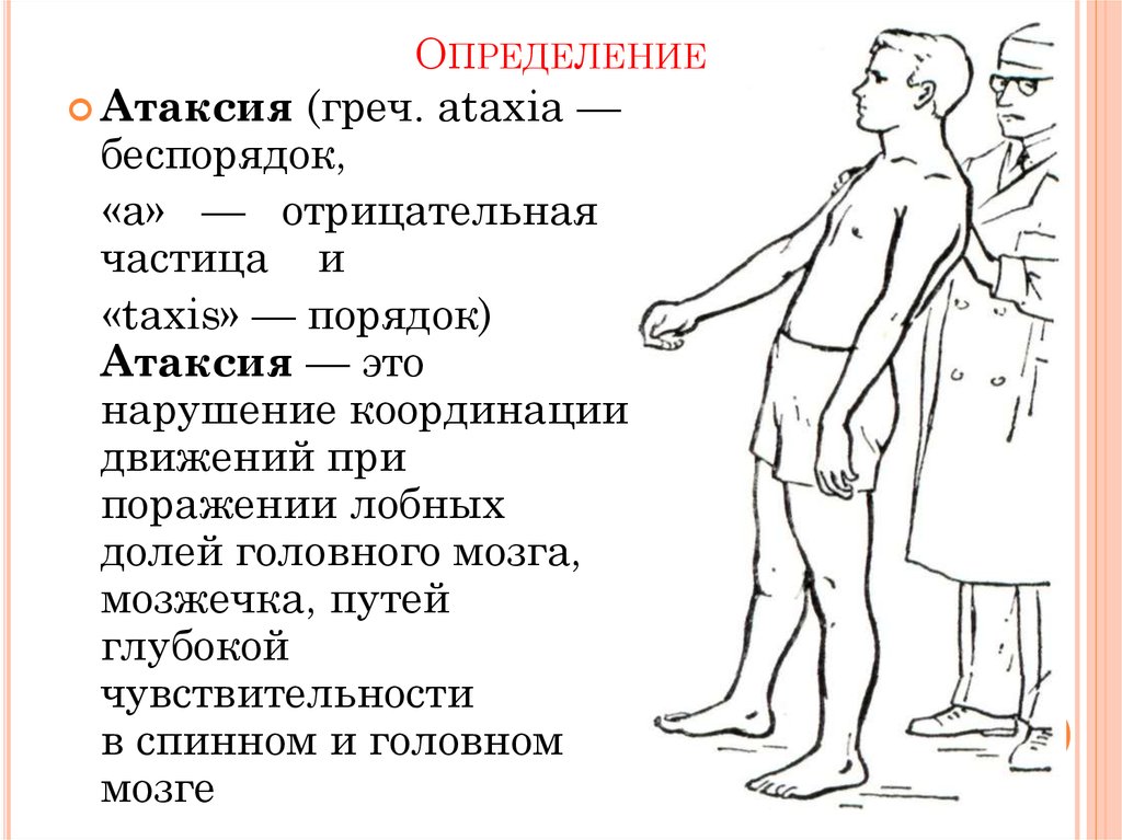 Атаксия