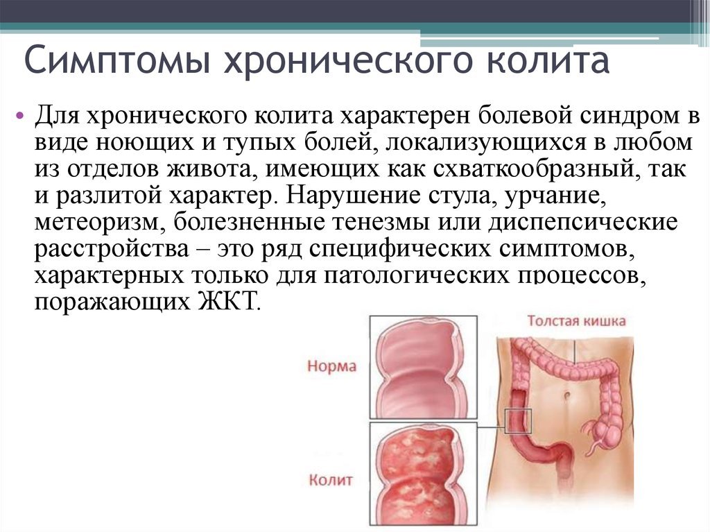 Колит