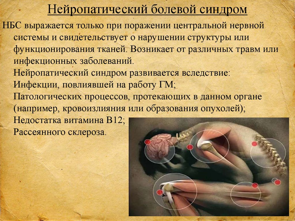 НБС
