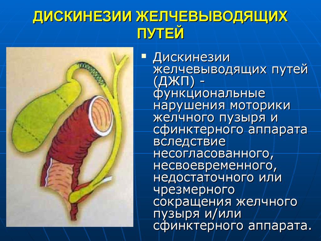 Дискинезия