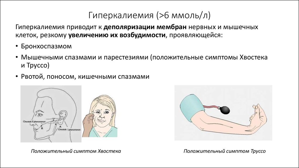 Гиперкалиемия