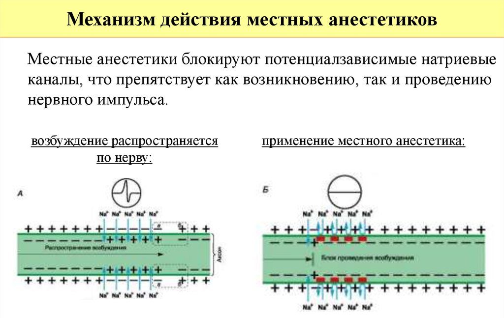 Механизм действия местных анестетиков