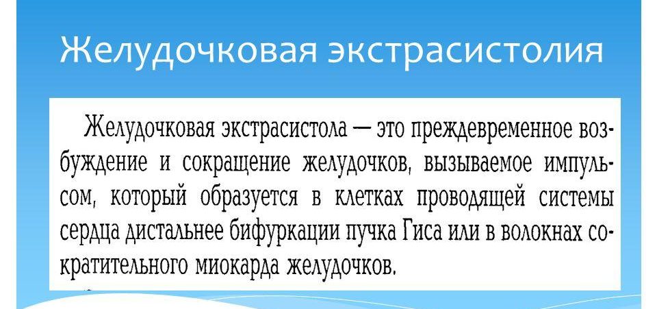 Экстрасистолия