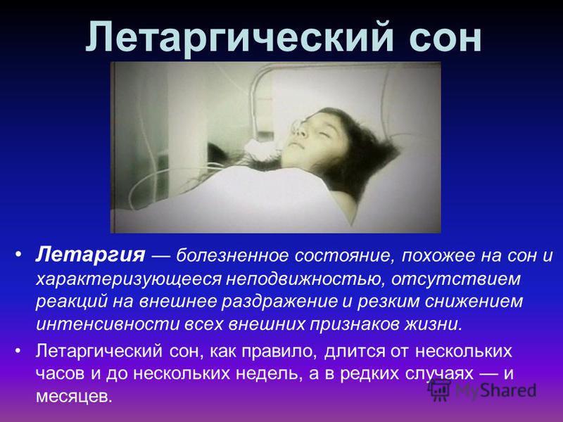Летаргия