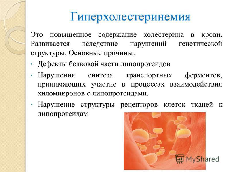 Гиперхолестеринемия