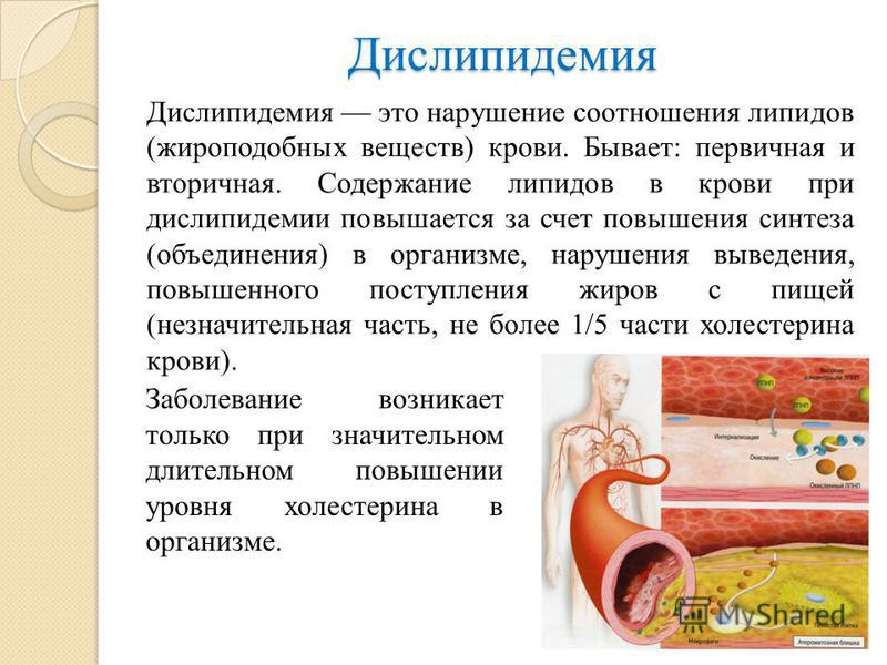 Дислипидемия