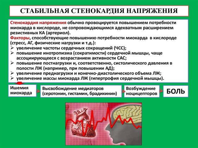 Стенокардия напряжения