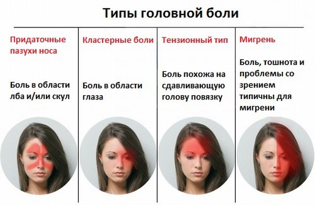 Виды головной боли