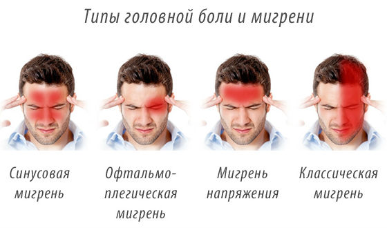 Типы головной боли