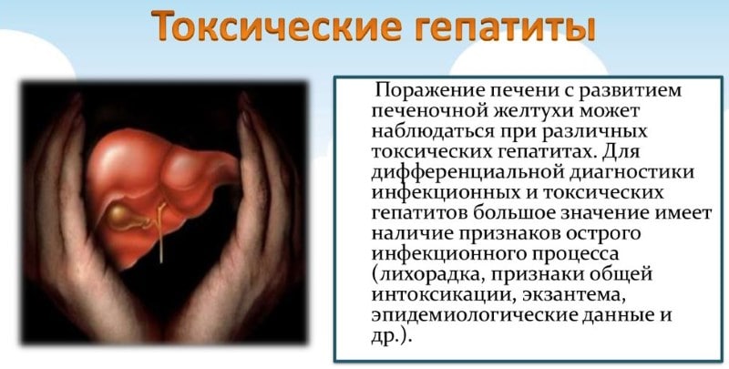 Токсический гепатит
