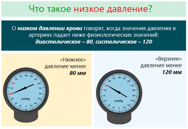 Гипотония