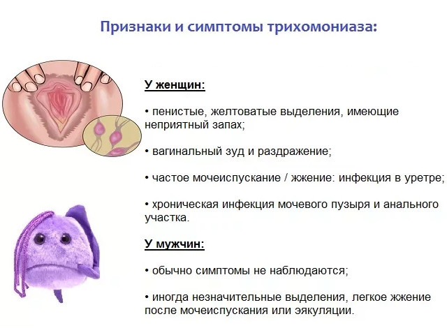 Трихомониаз
