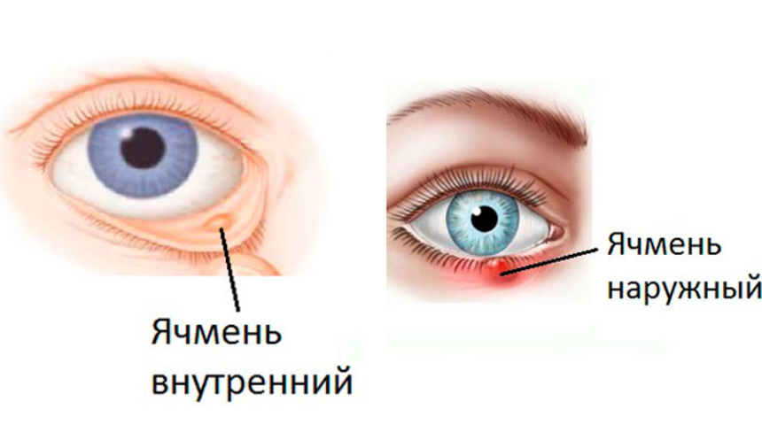 Ячмень